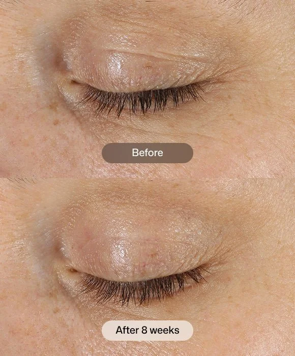 d-e-j-eye-cream-.50 before and after.jpg