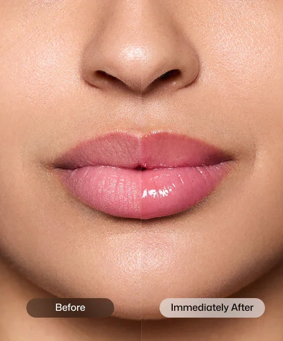Revision-tinted-youthfull-lip-replenisher-Before-and-After.webp