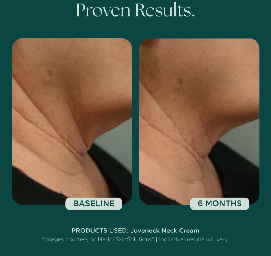 Meraki Marini Juvaneck Before_After.png
