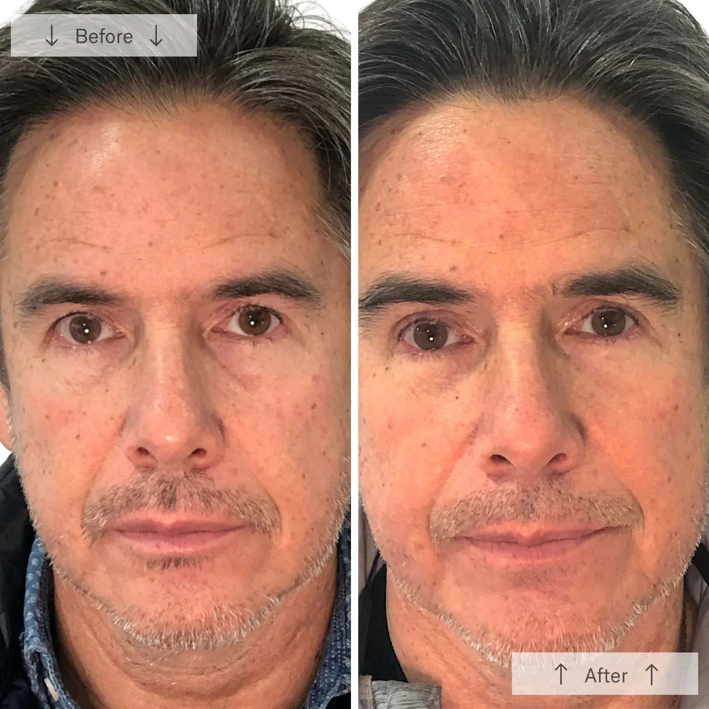 Meraki Omnilux Men_6.webp