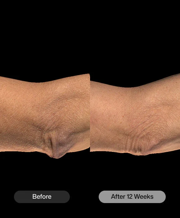 Meraki Revision BodiCountour Skin Firming.webp