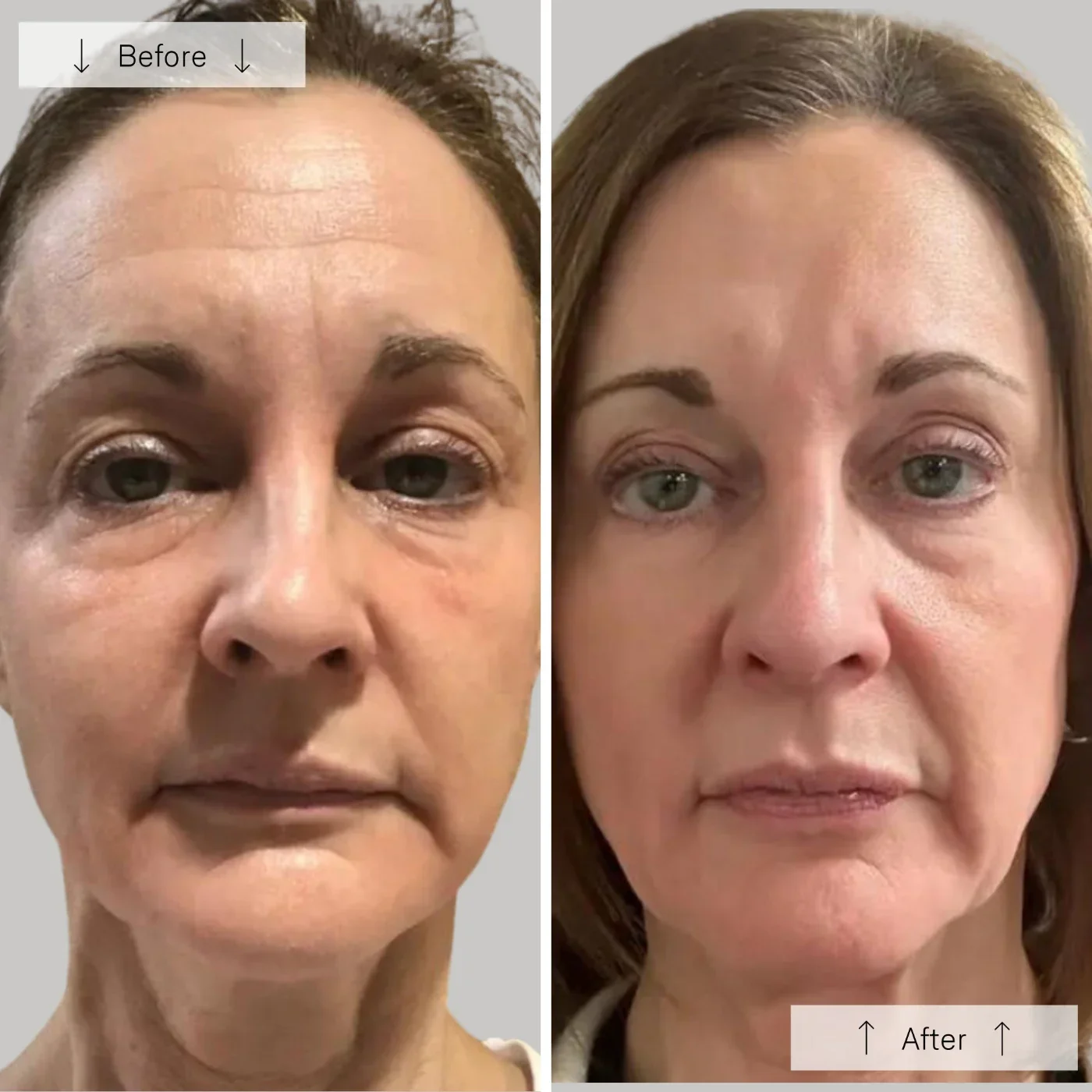 Meraki Omnilux Contour_Face_Cover_Image_7.webp