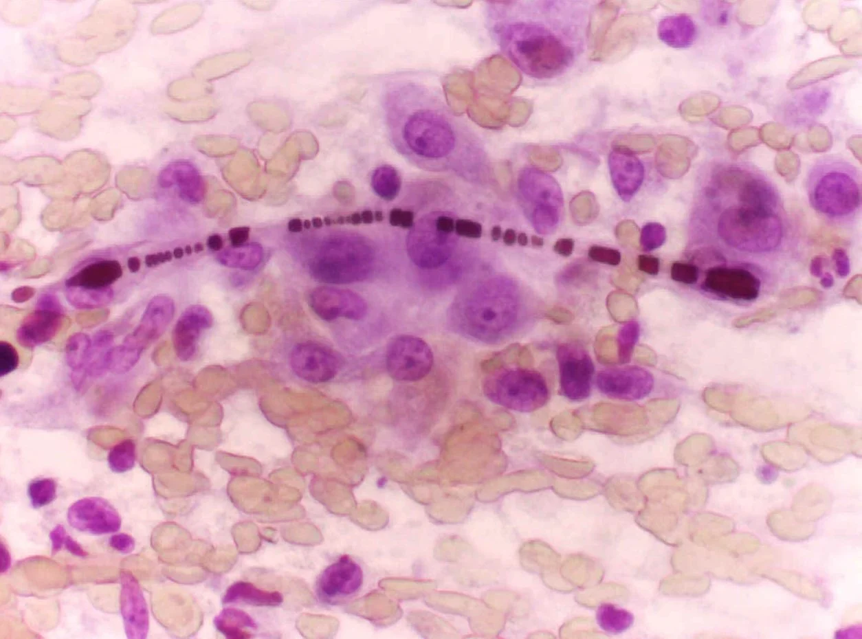 An asbestos fiber embedded in lung cells.