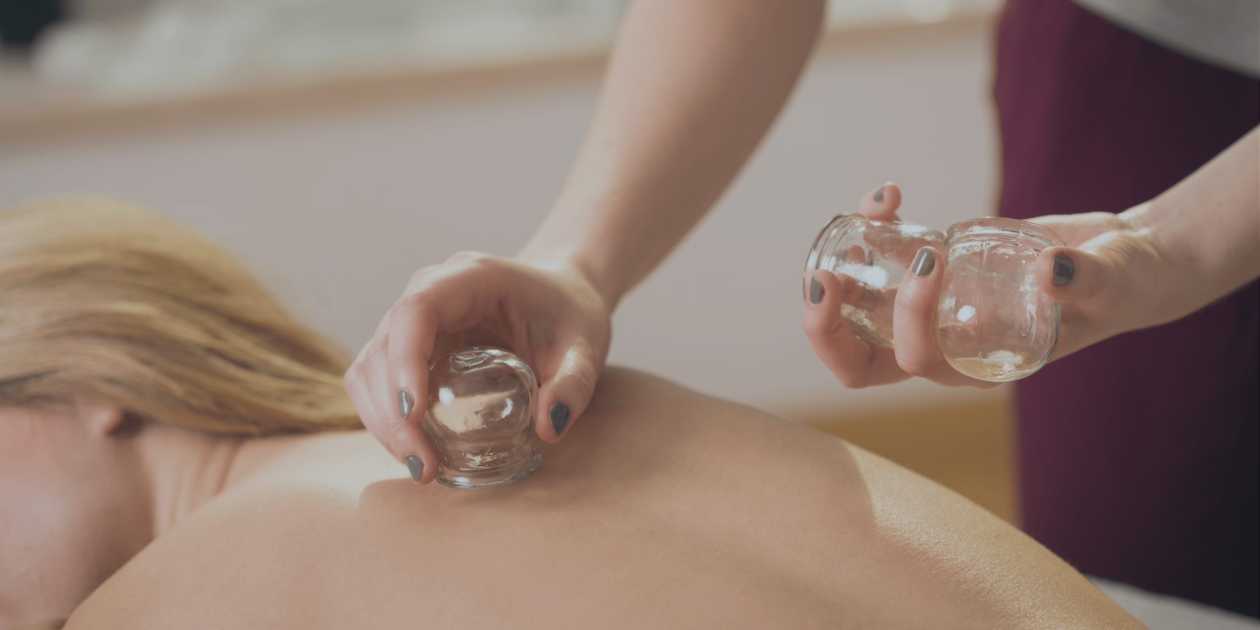 A person receiving cupping therapy with multiple glass cups on their back while a practitioner uses a suction device.