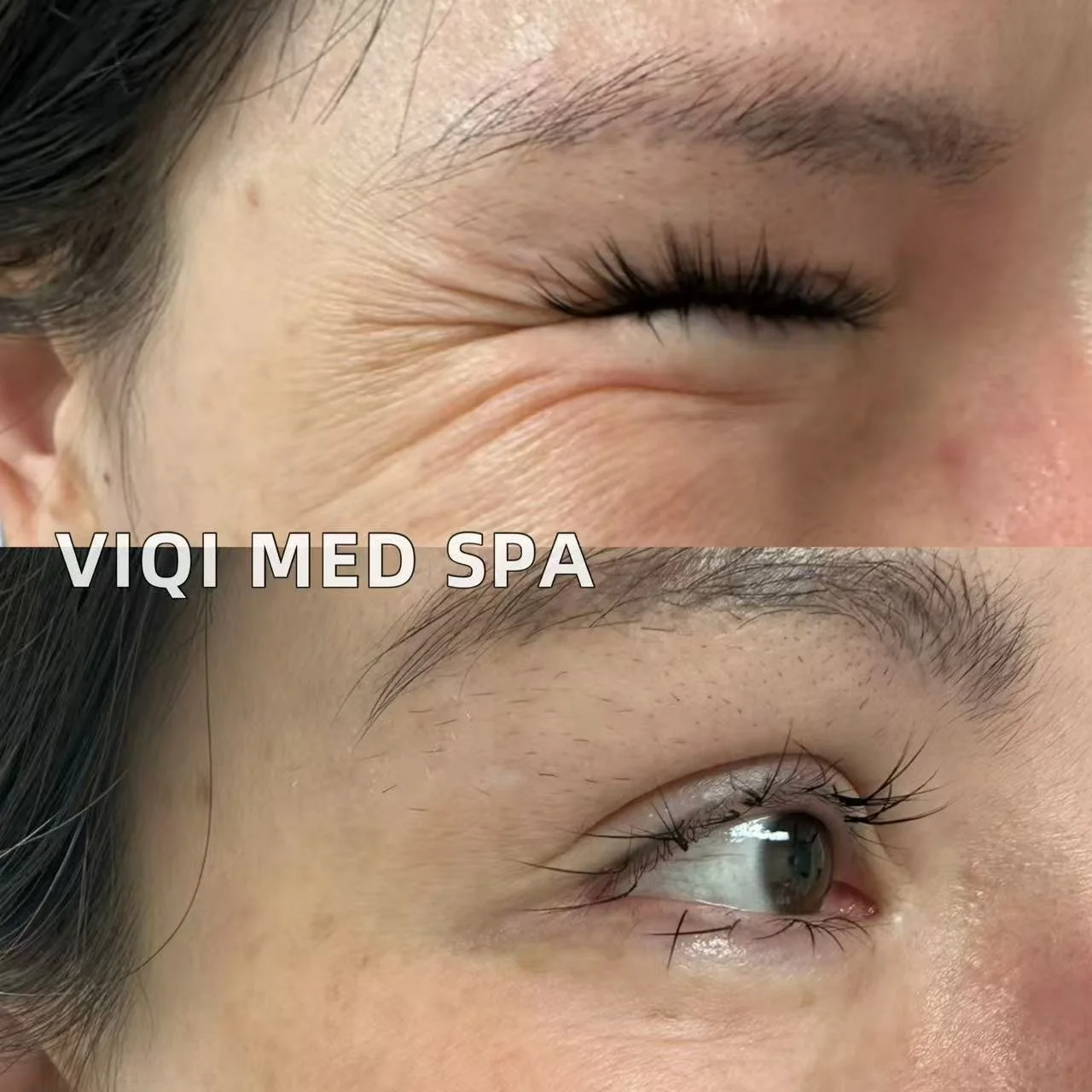 Expression Lines · VIQI Patient Results