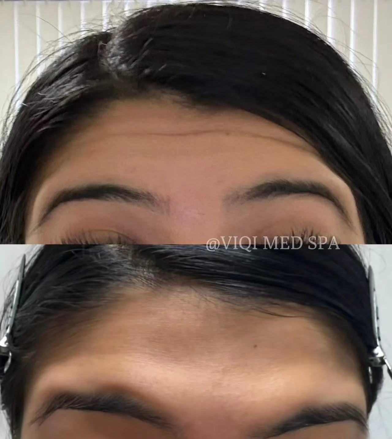 Expression Lines · VIQI Patient Results