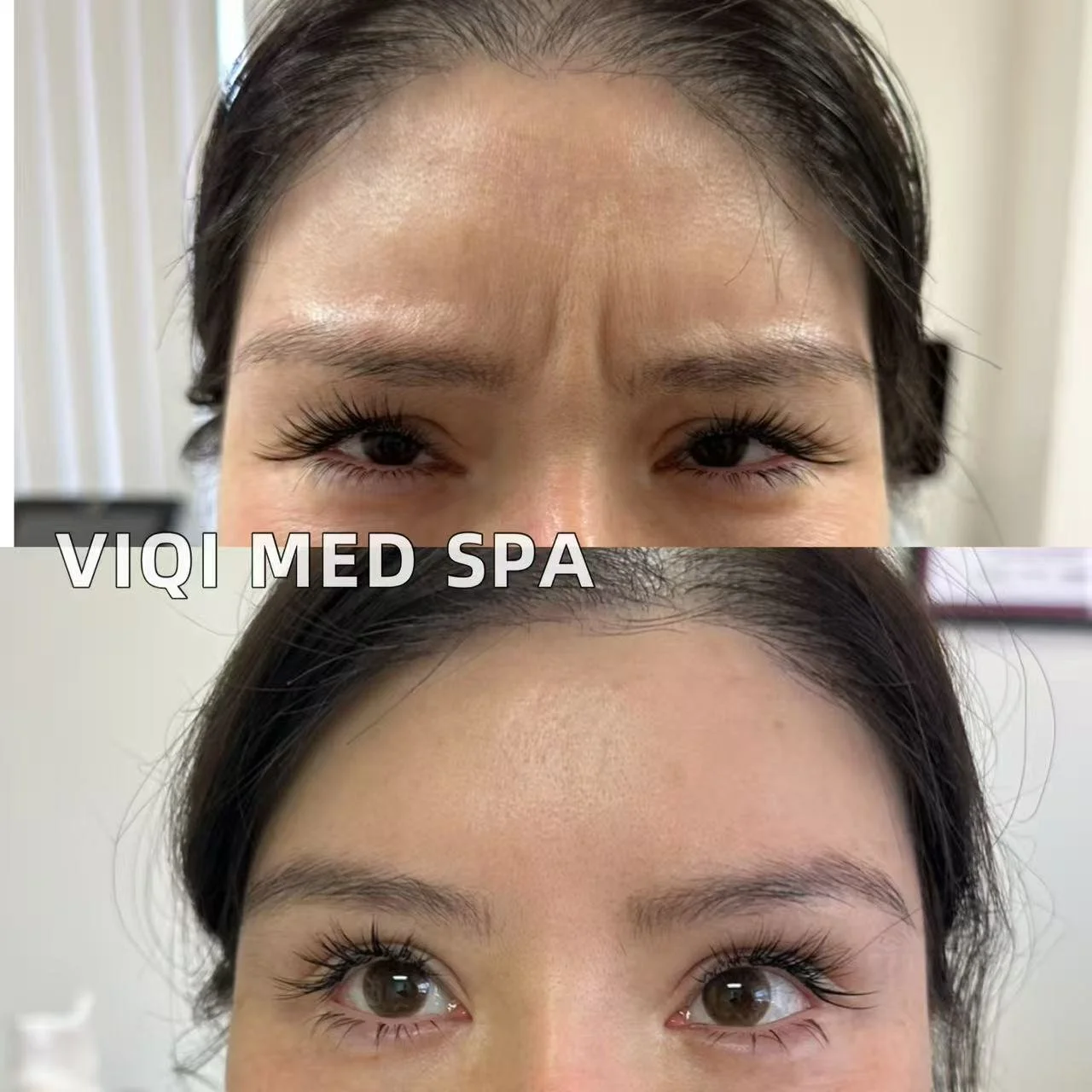 Expression Lines · VIQI Patient Results