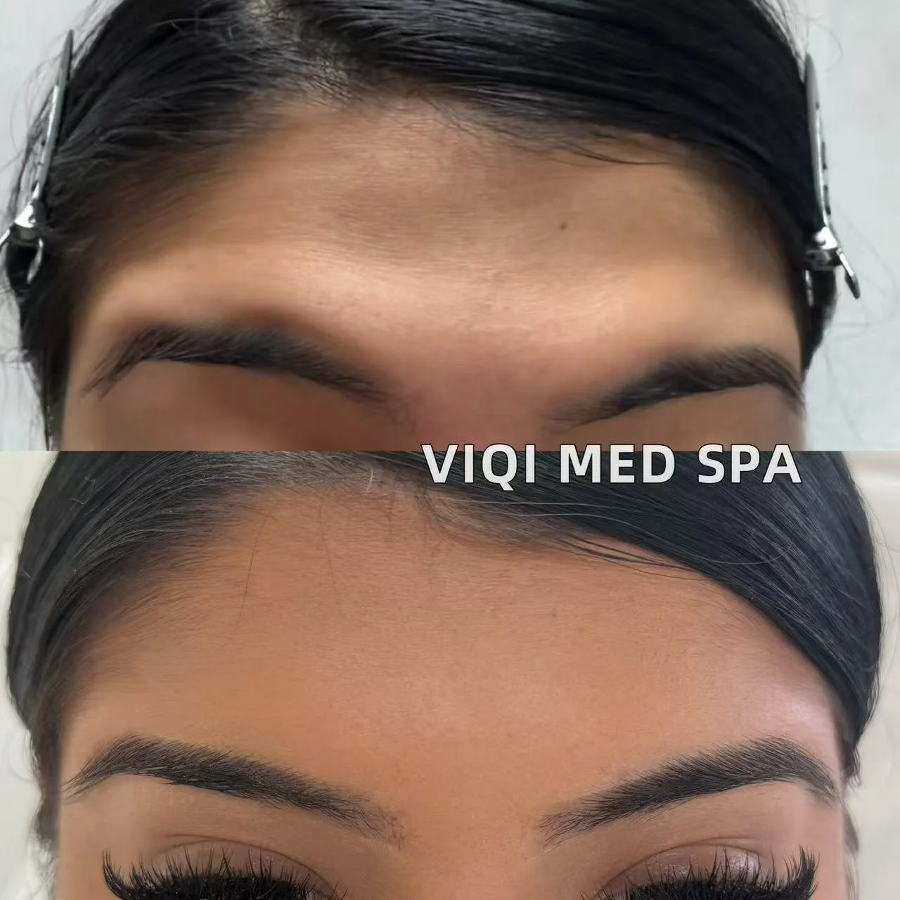 Expression Lines · VIQI Patient Results