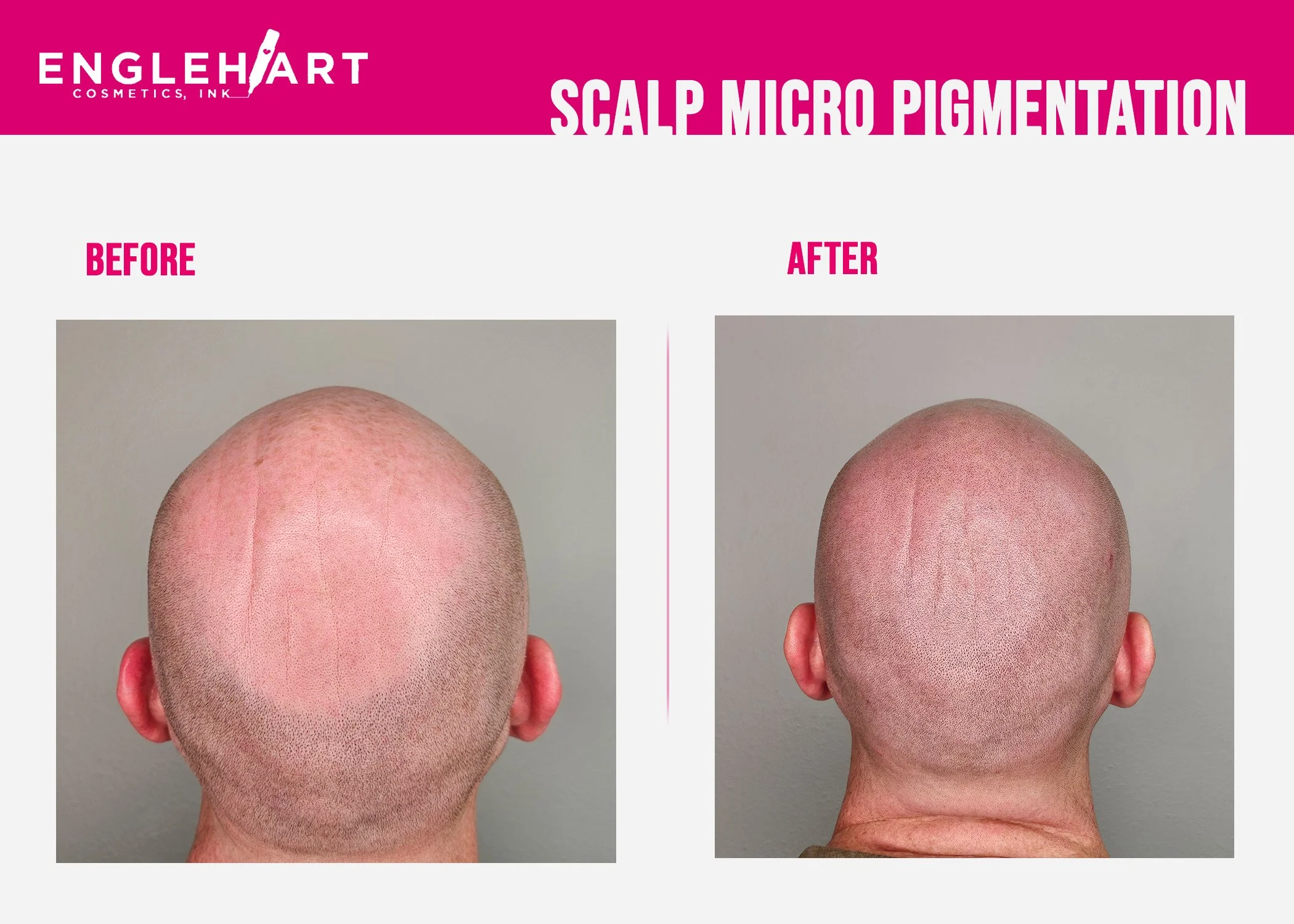 scalp3.jpg