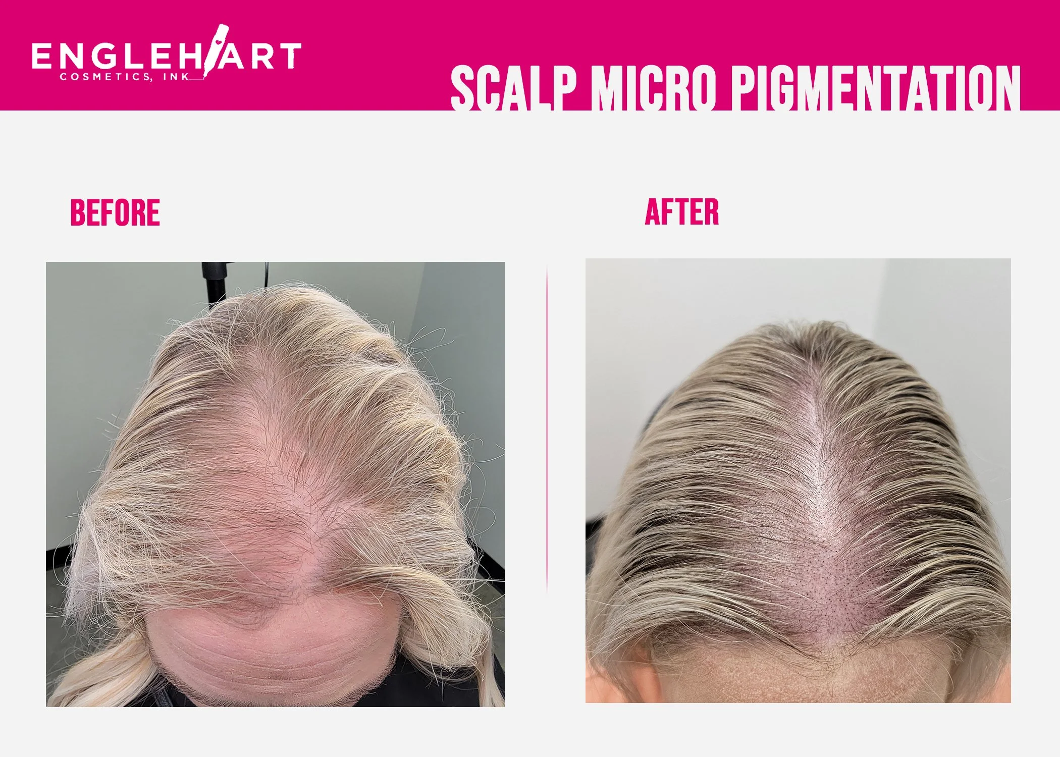 scalp2.jpg