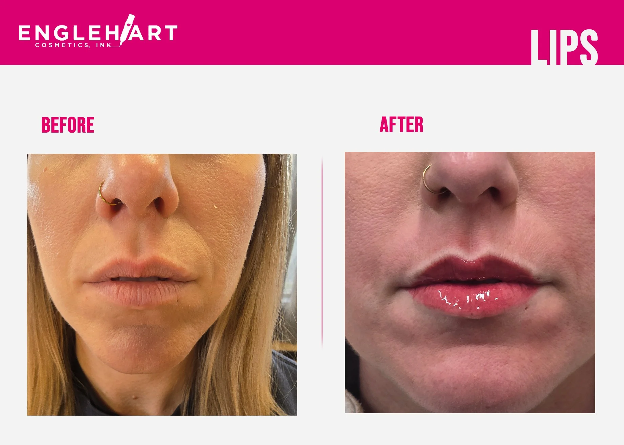 LIPS.JPG