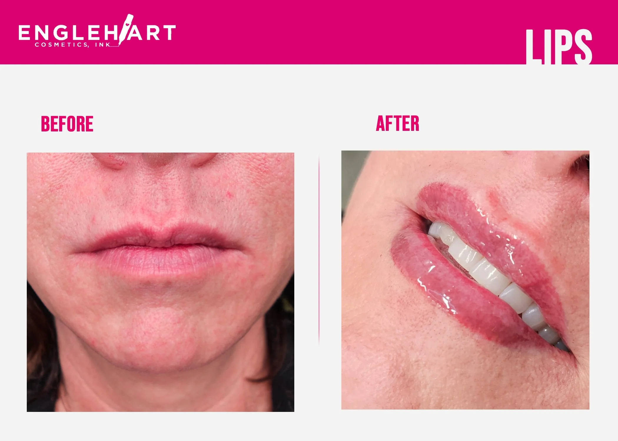 lips2.jpg