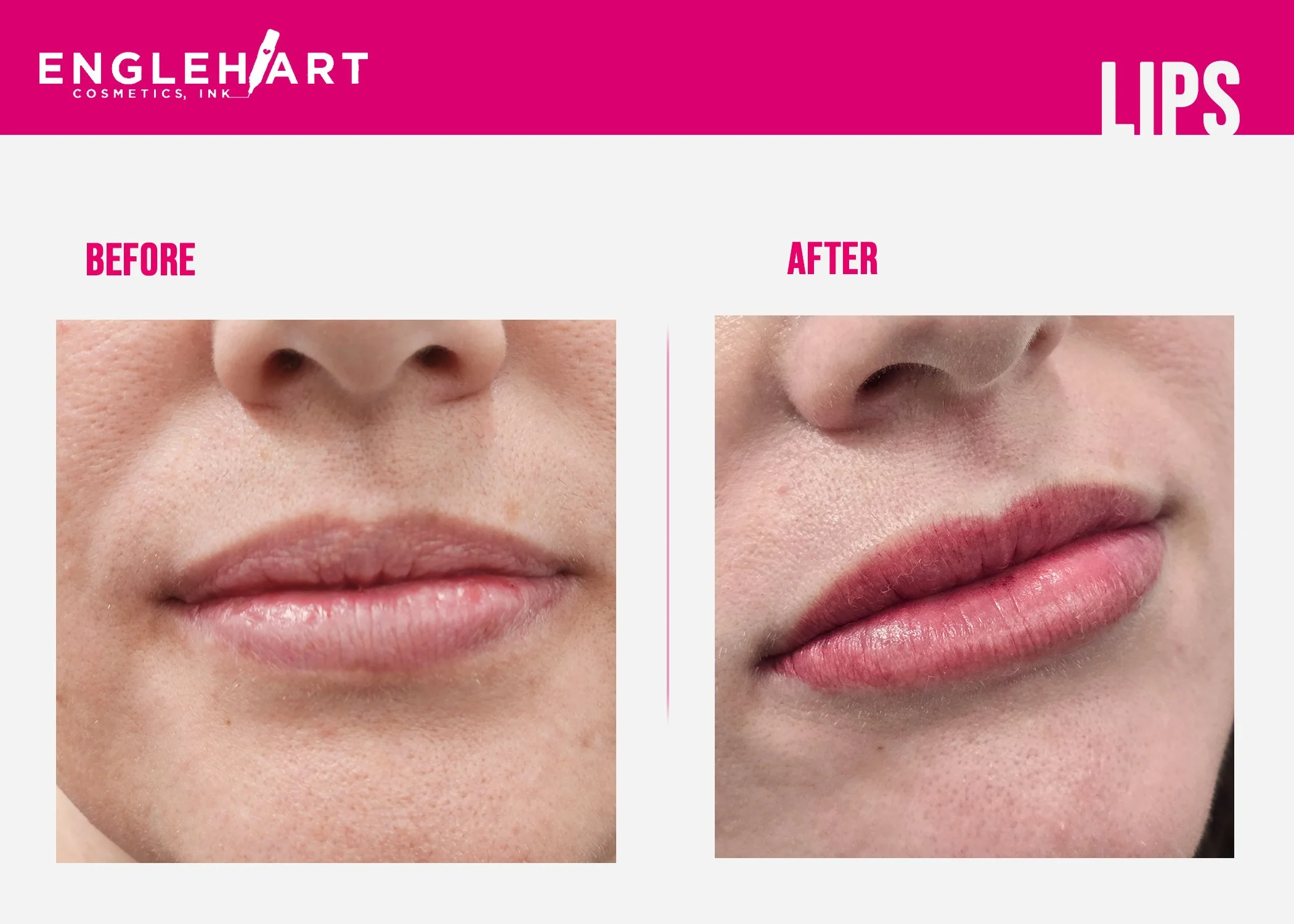lips4.jpg