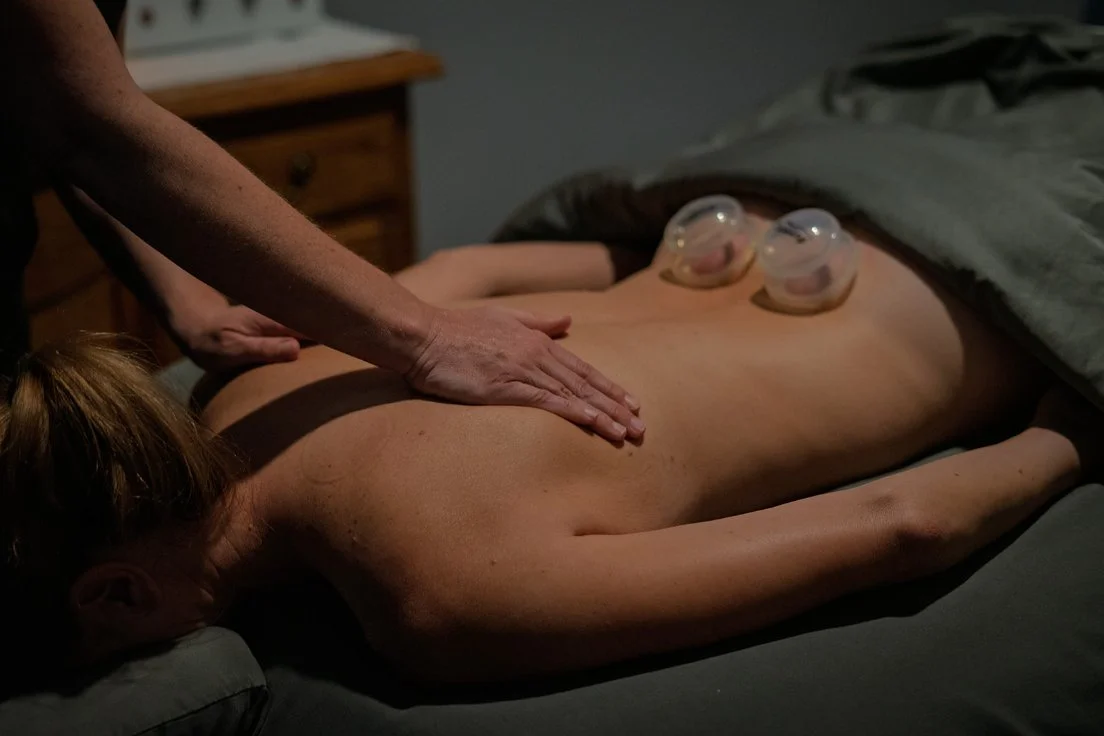 What Is Cupping Therapy? Guide to Pain Relief in Cedar City