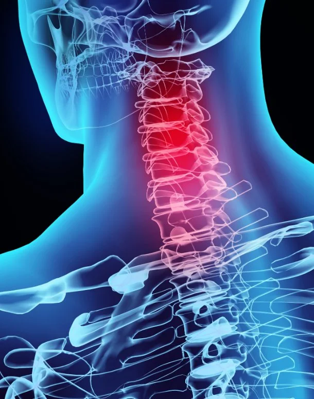 Tech Neck