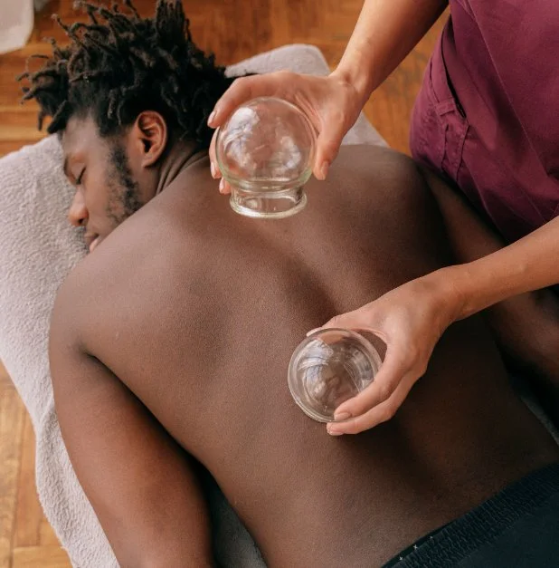 Cupping