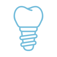 Light blue outline of a tooth with a screw-in base, resembling a dental implant