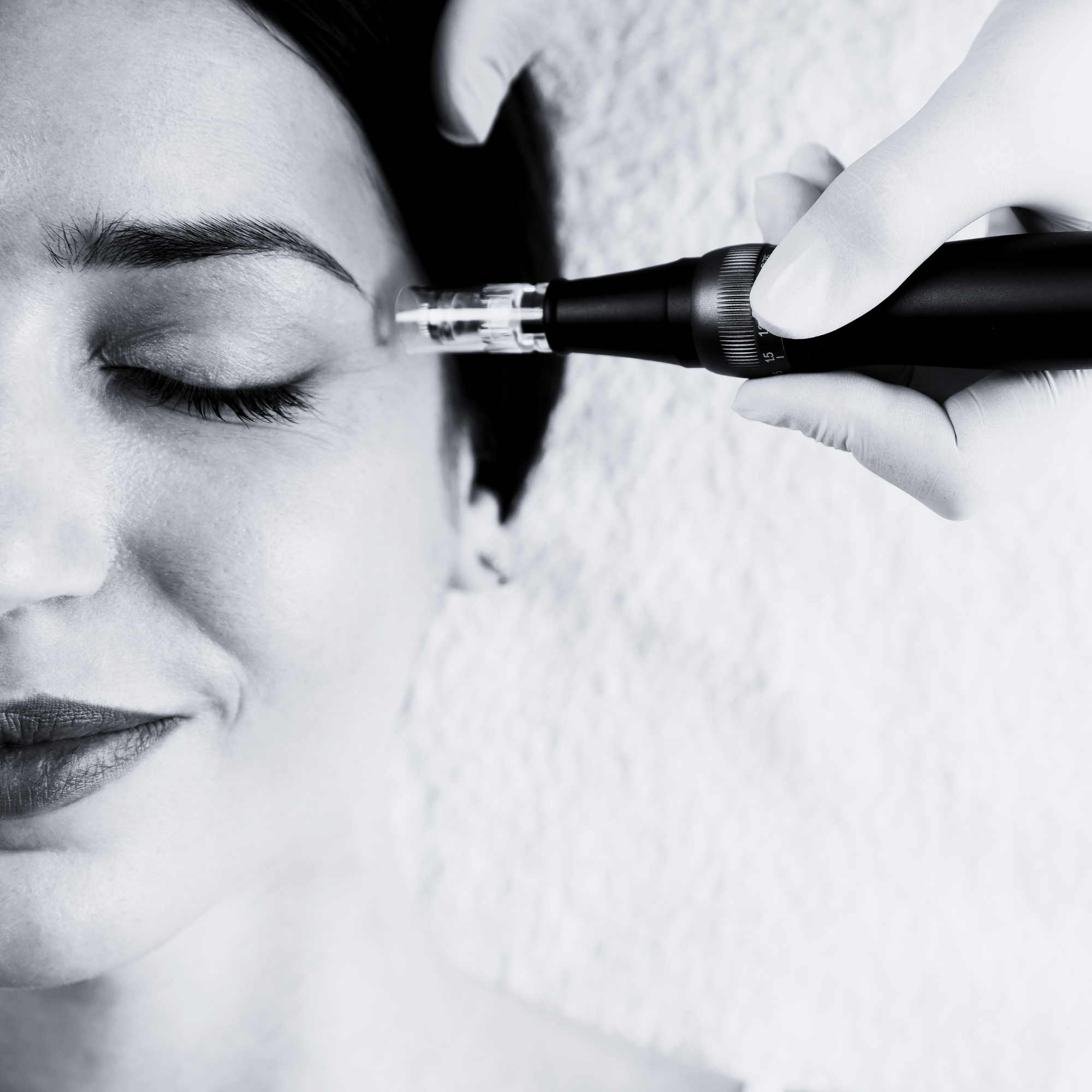 A precision microneedling treatment being performed by Dr. Bita Farrell to stimulate collagen and refine skin texture in her Westlake Village studio.