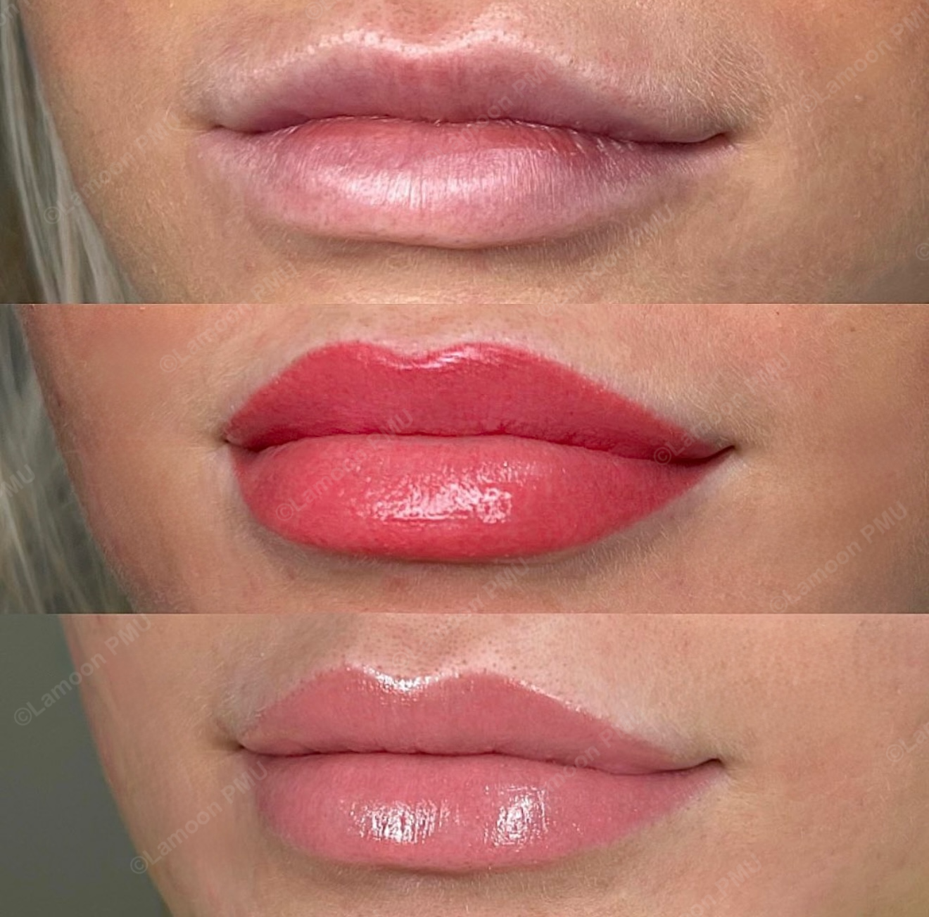 Restored lip border and enhanced color to give lips a fuller, healthier appearance.