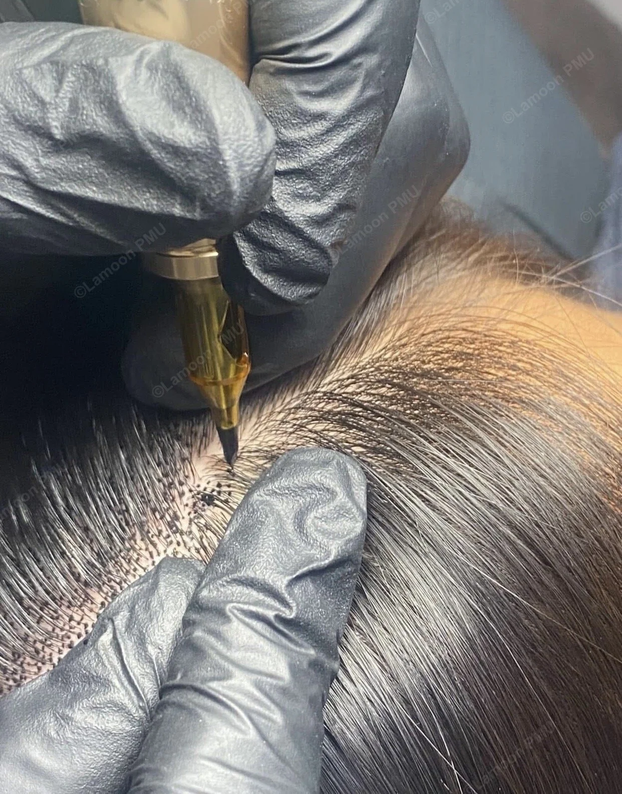 Scalp micropigmentation practitioner applying pigment to female hair parting.