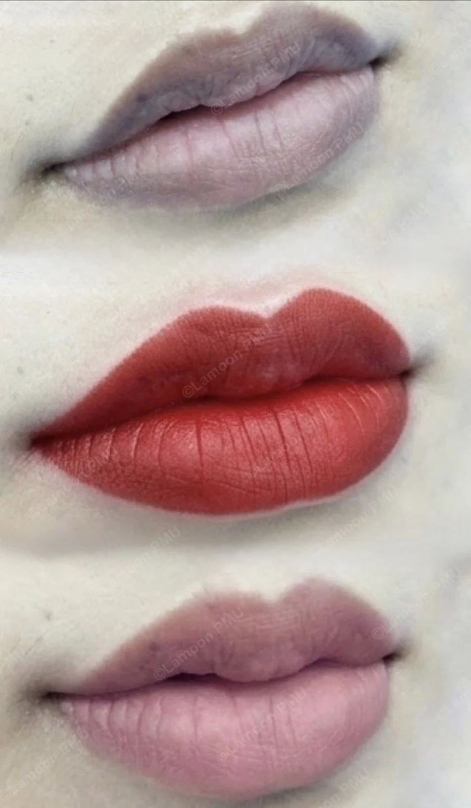 Advanced lip neutralization targeting uneven pigmentation. We corrected the deeper tones to achieve this balanced, natural-looking peach-pink finish.