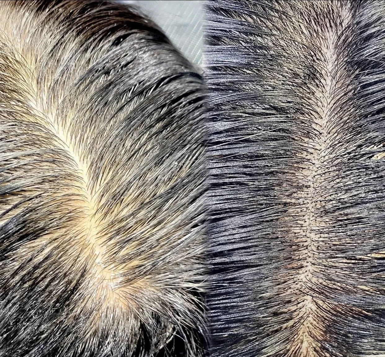 Extreme macro photo comparing natural hair density before and after scalp micropigmentation.