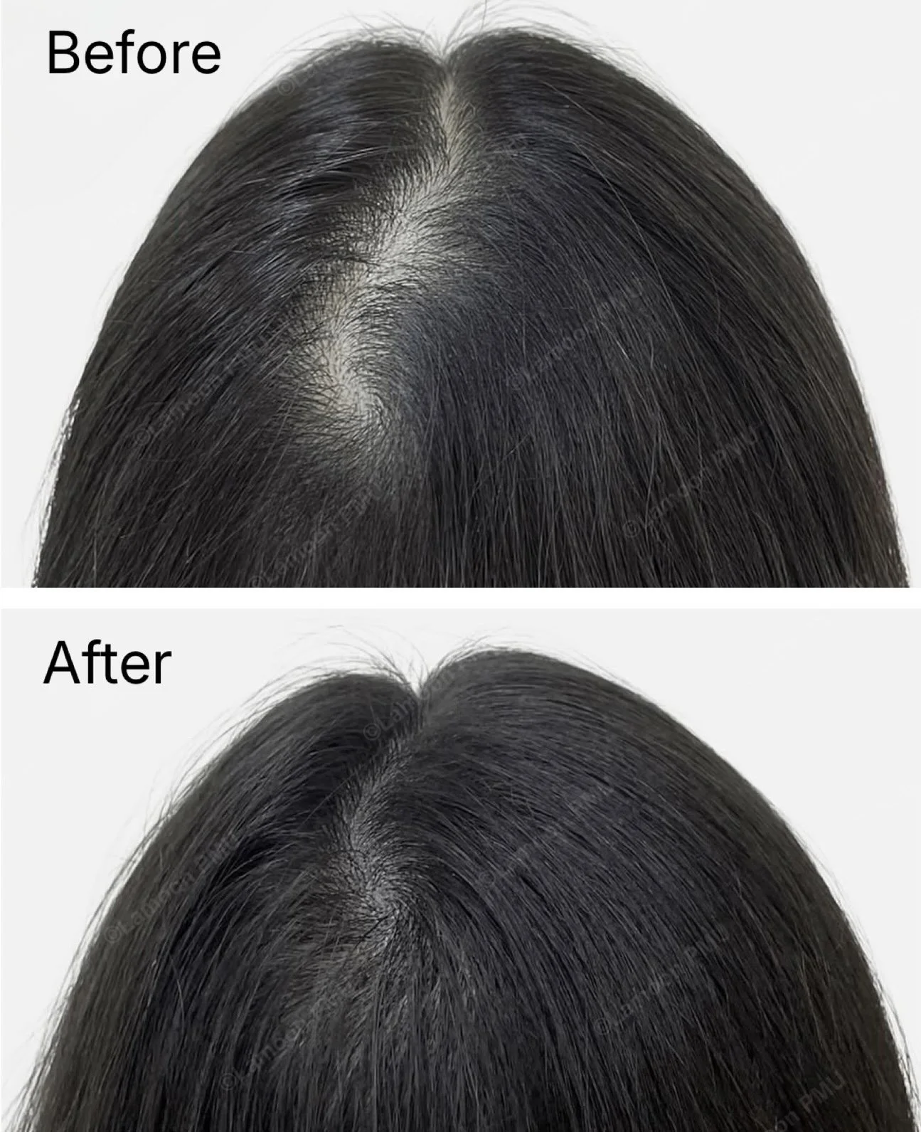 Before and after scalp micropigmentation treatment for female hair thinning along the part line.