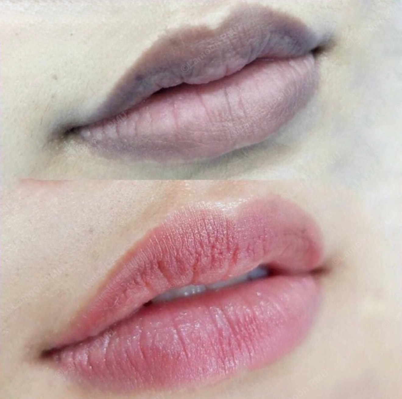 Lip neutralization to even out tones and create a bright, fresh pink finish.