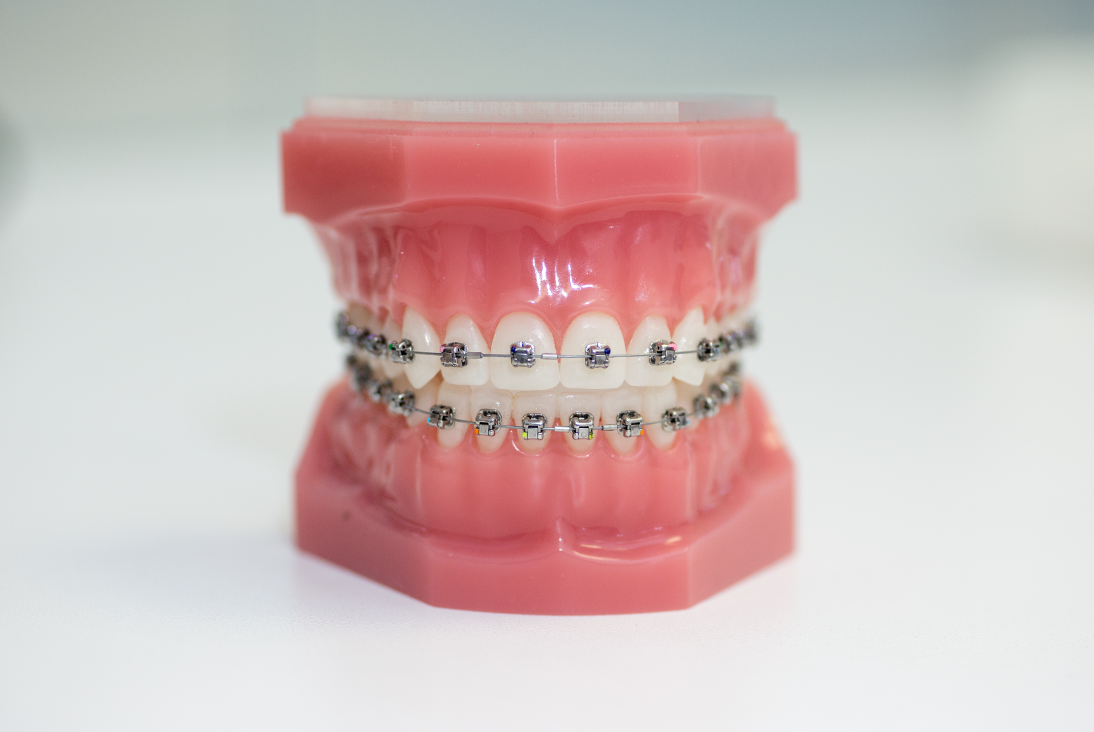 Metal braces treatment in Crows Nest