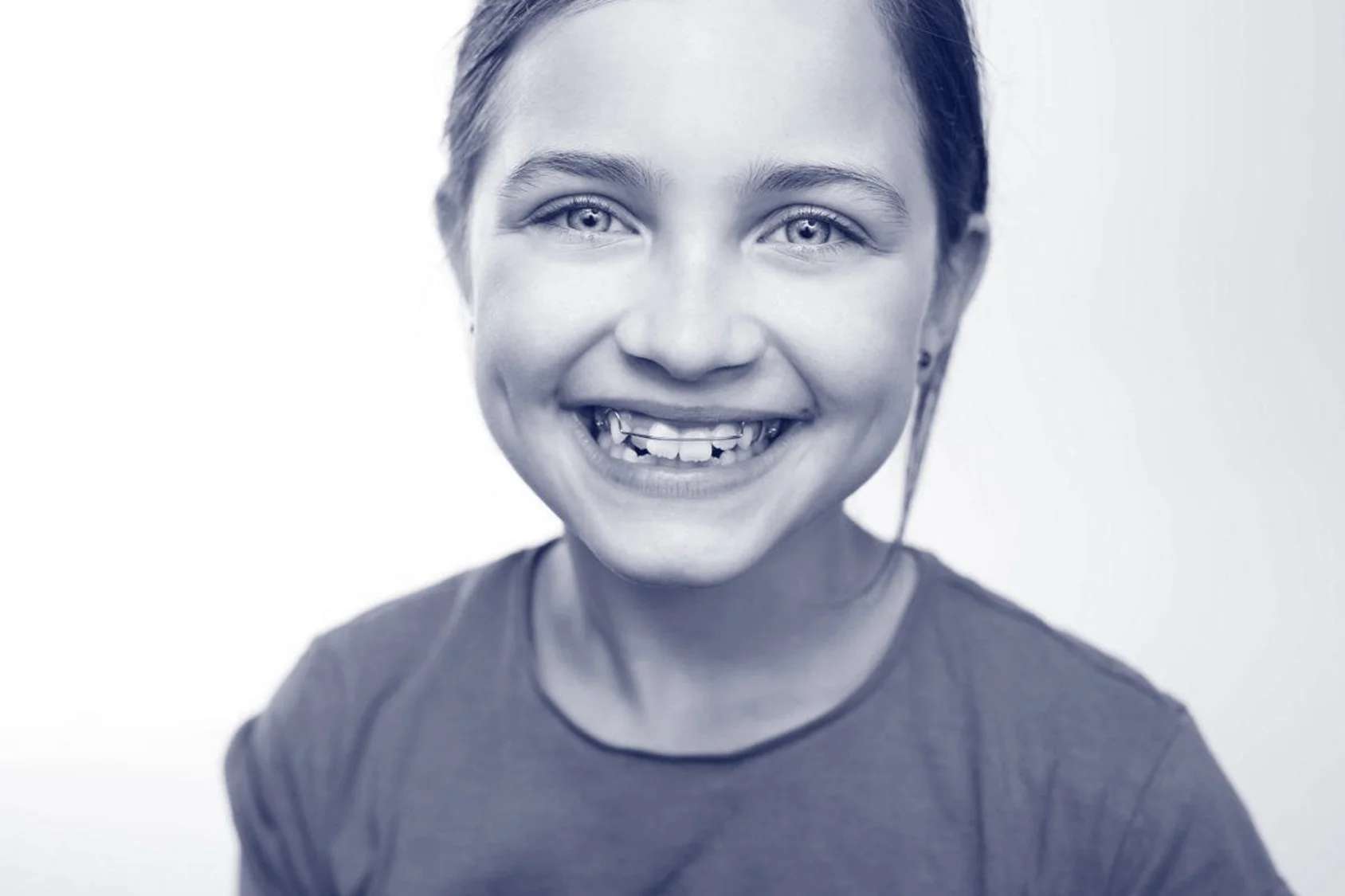 Orthodontic appliances in Crows Nest