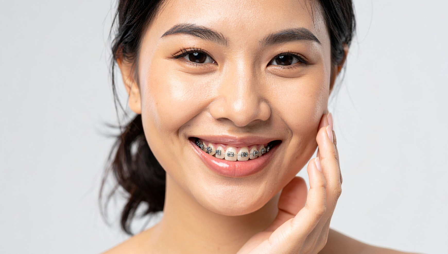 Adult orthodontic treatment with discreet options