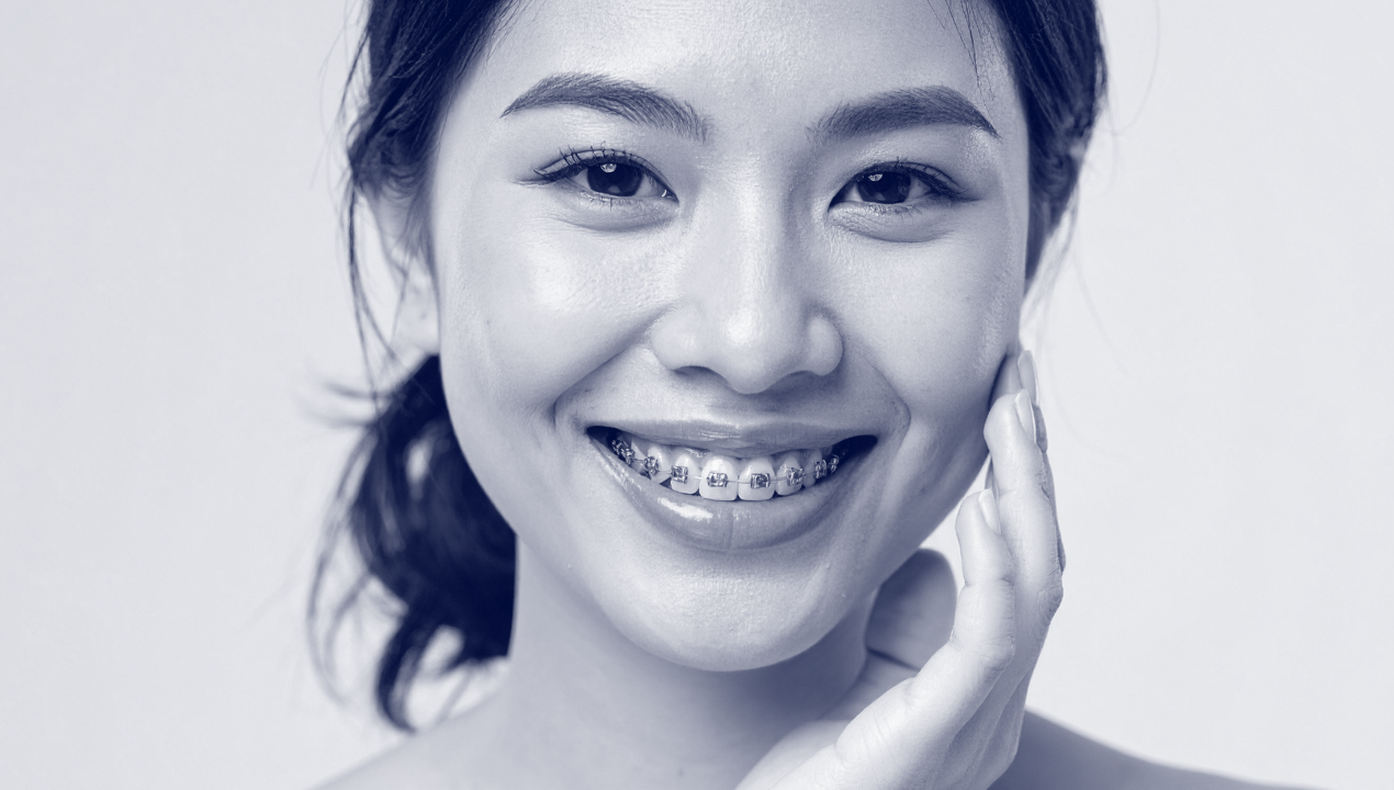 Braces treatment in Crows Nest, North Sydney, North Shore