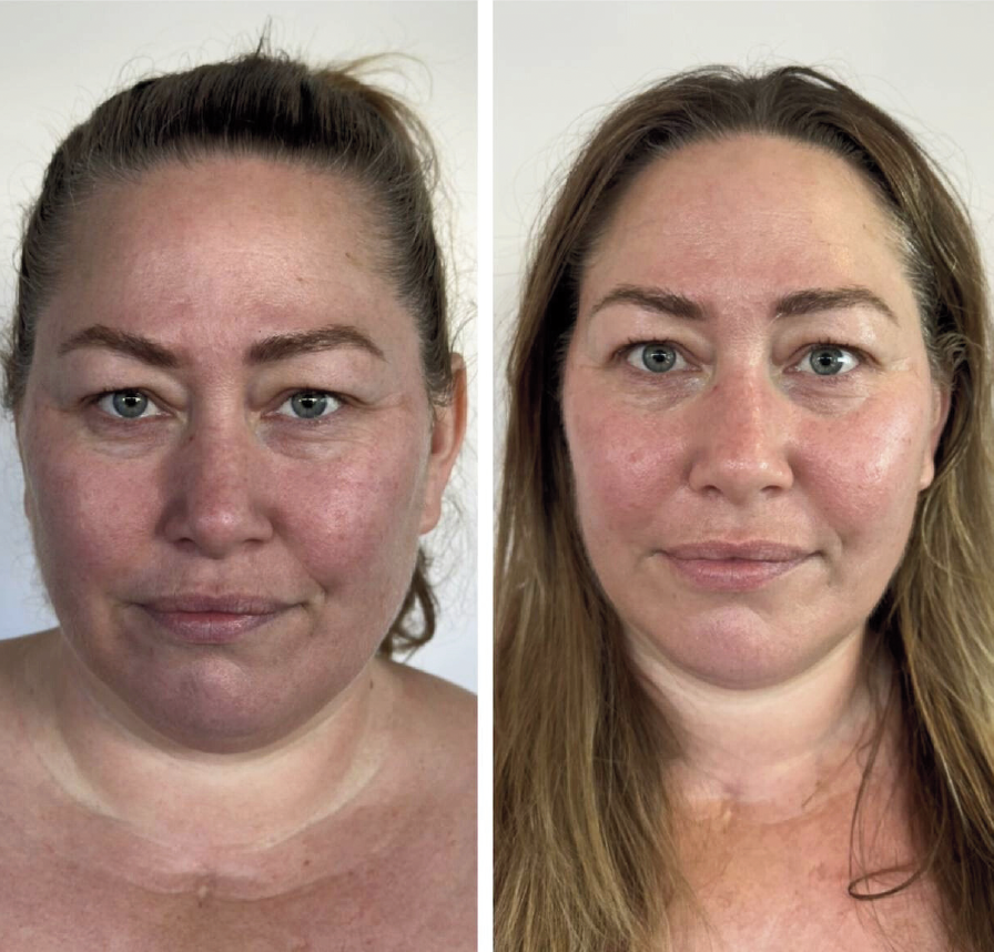 Geometric drawing of an outline square with sections divided by vertical, horizontal, and diagonal lines.