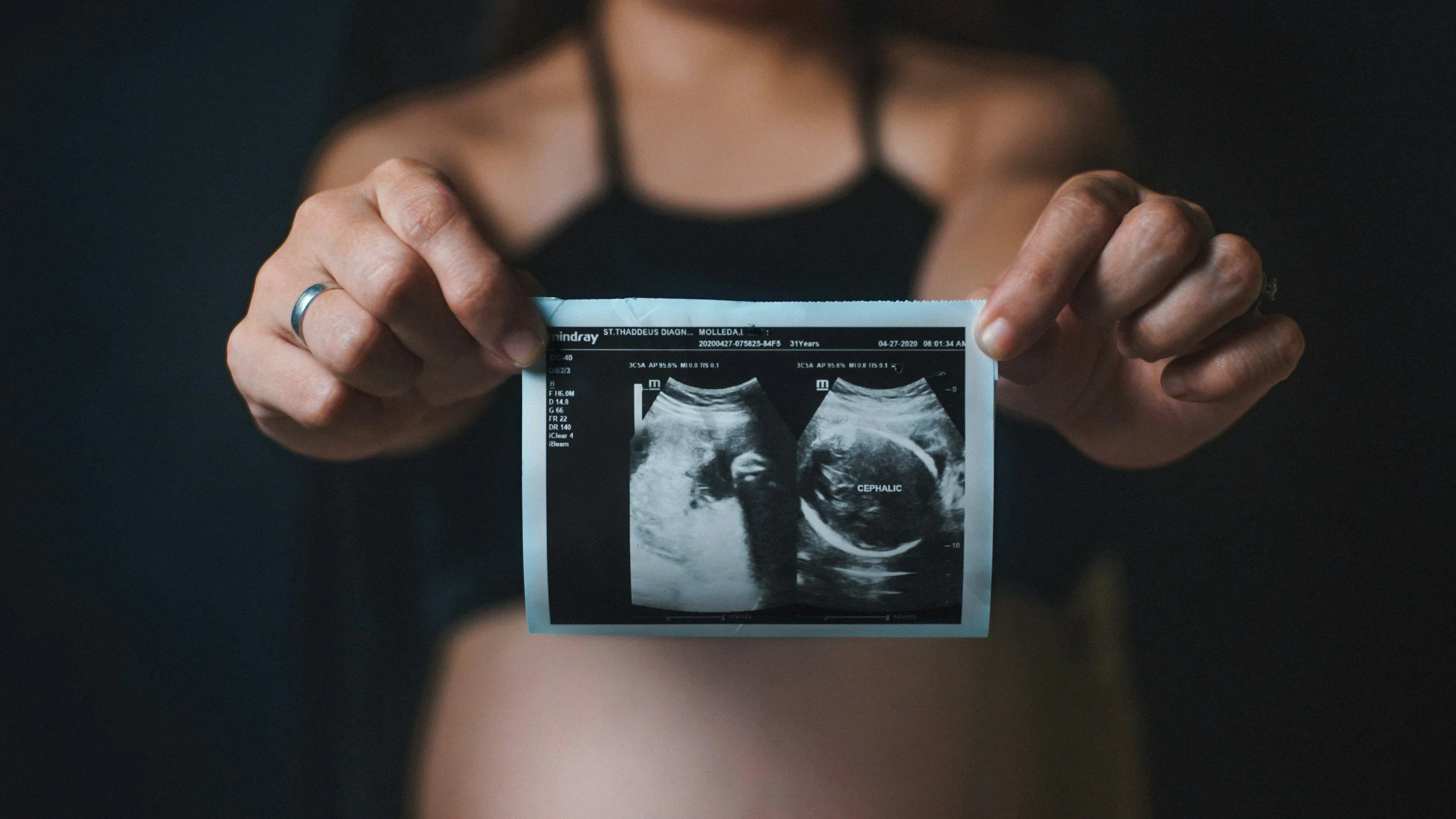 A person holding an ultrasound scan of a fetus, with the word 'CEPHALIC' on it, against a dark background.