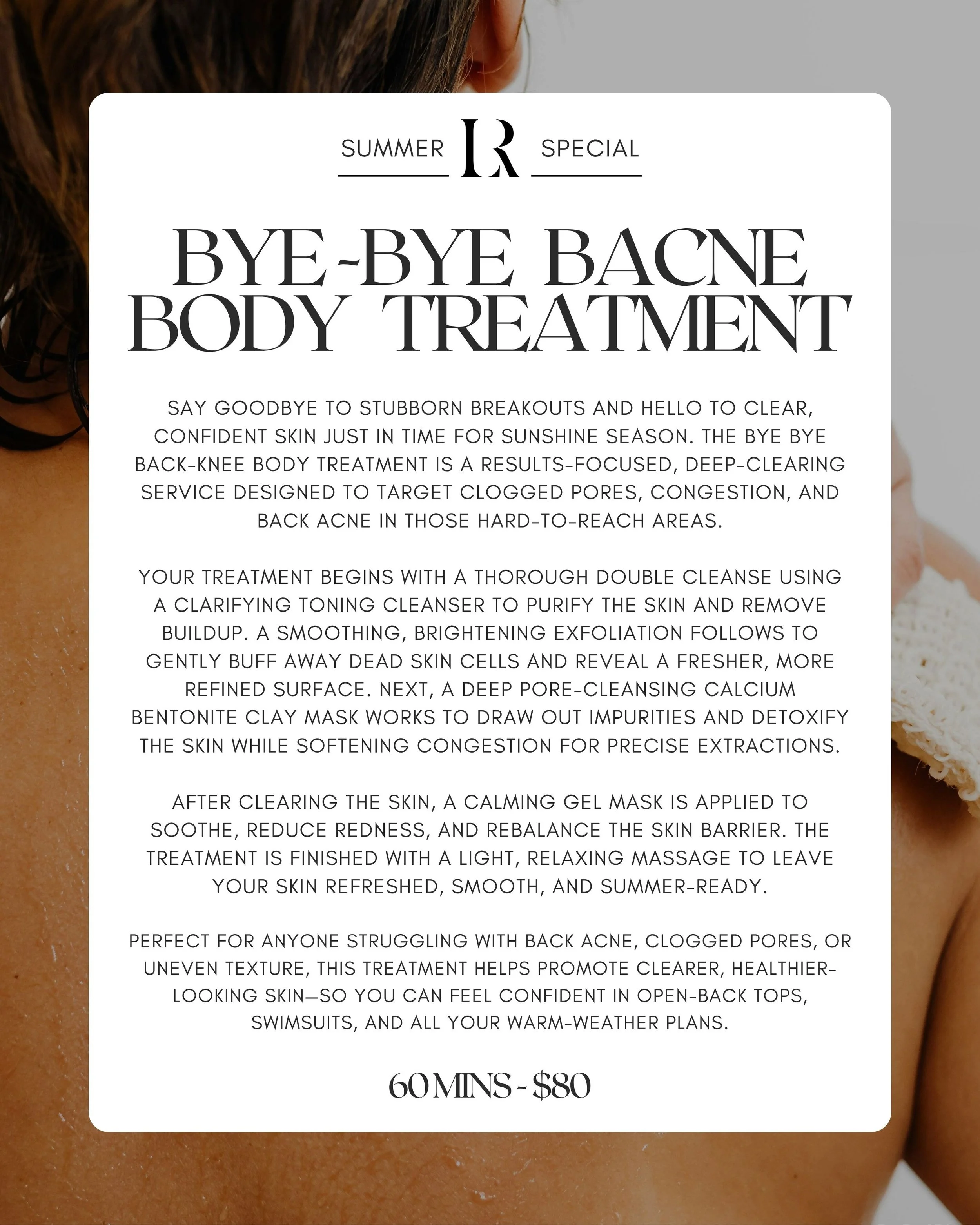 A promotional flyer for a back acne treatment service, featuring a background image of a woman's back and a white overlay with black text describing the treatment process and pricing.