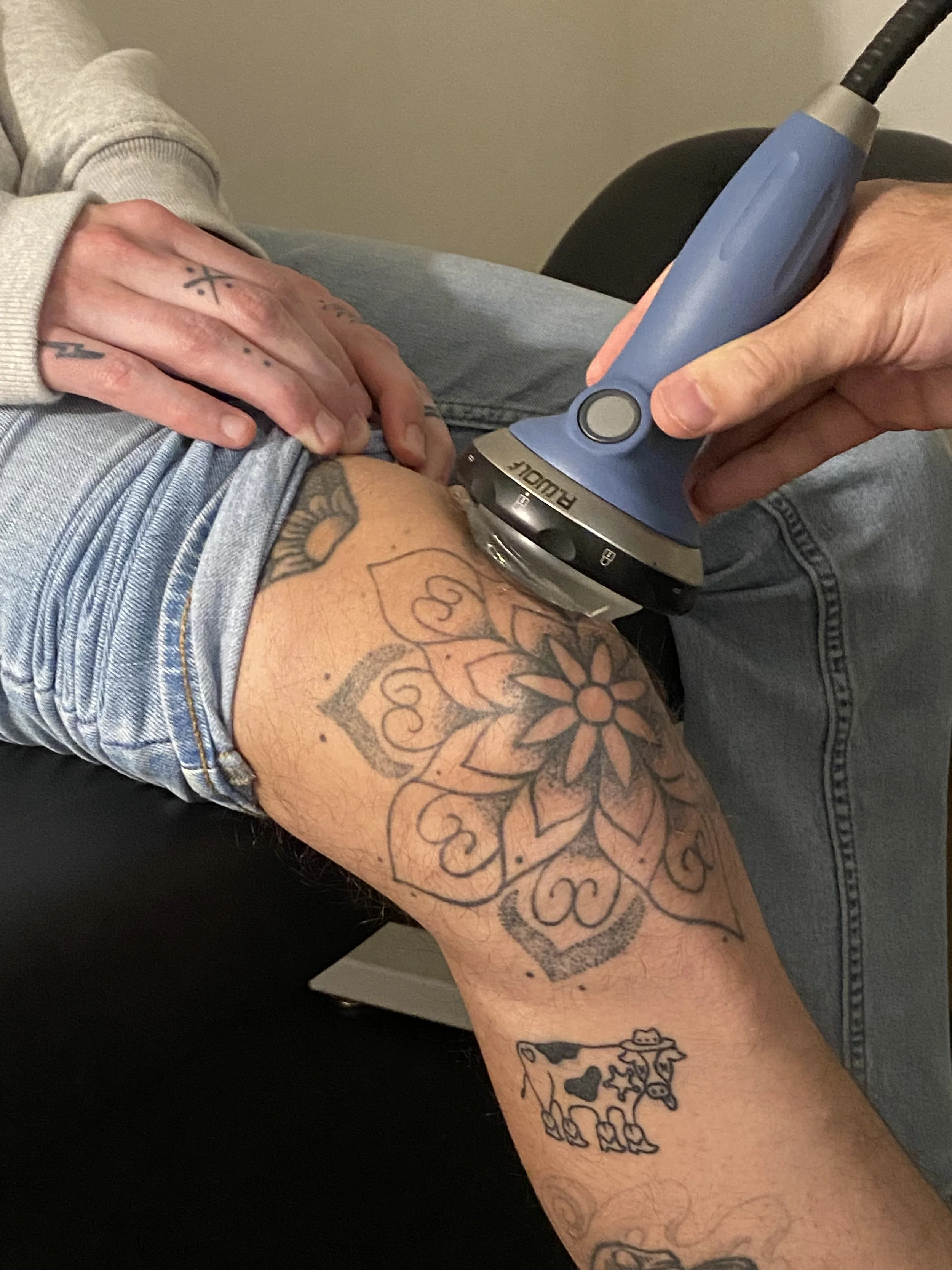 A person's arm with tattoos, wearing denim shorts, with a medical device attached to the upper arm for a blood test or injection.