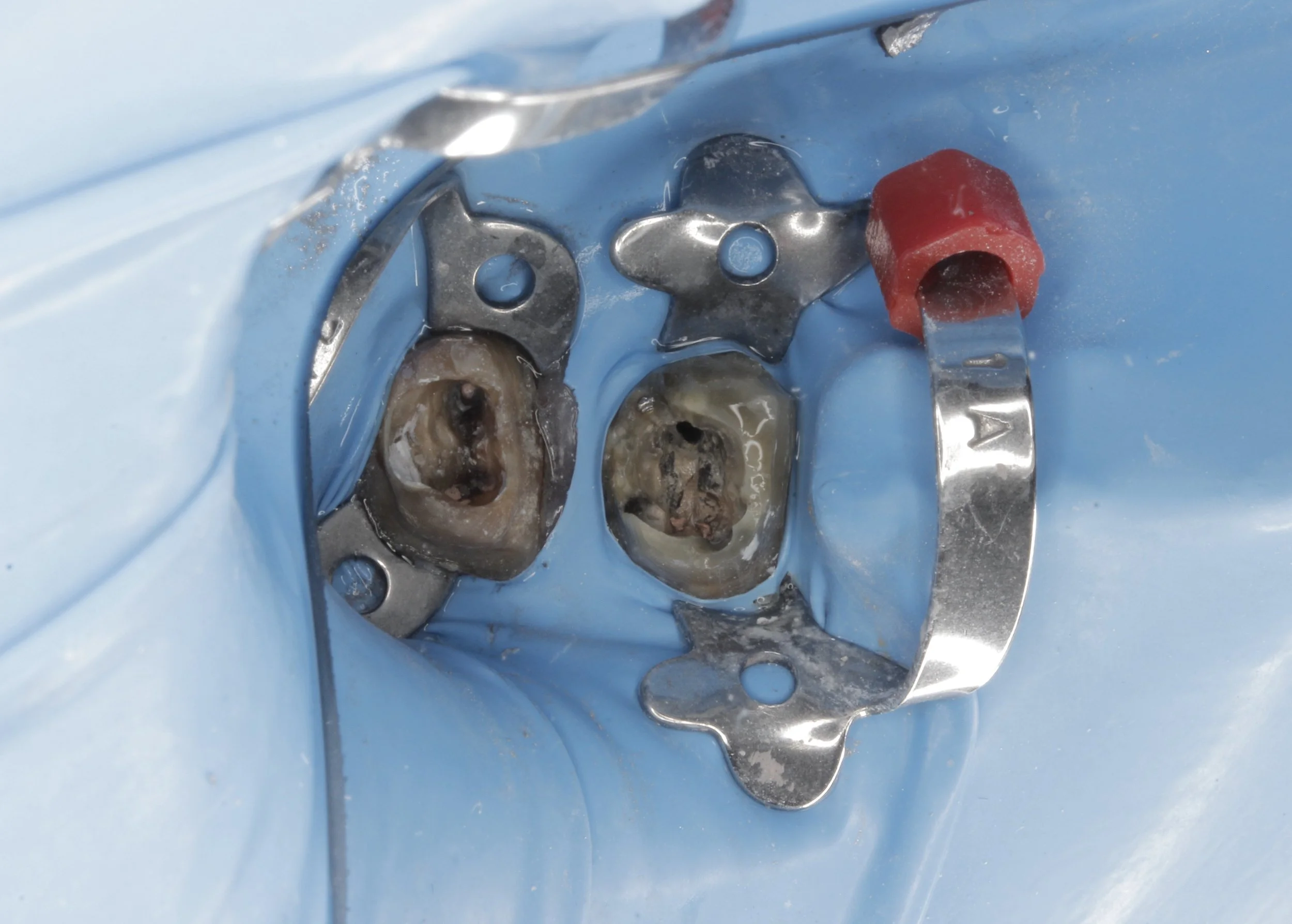 retiro de postes.JPG