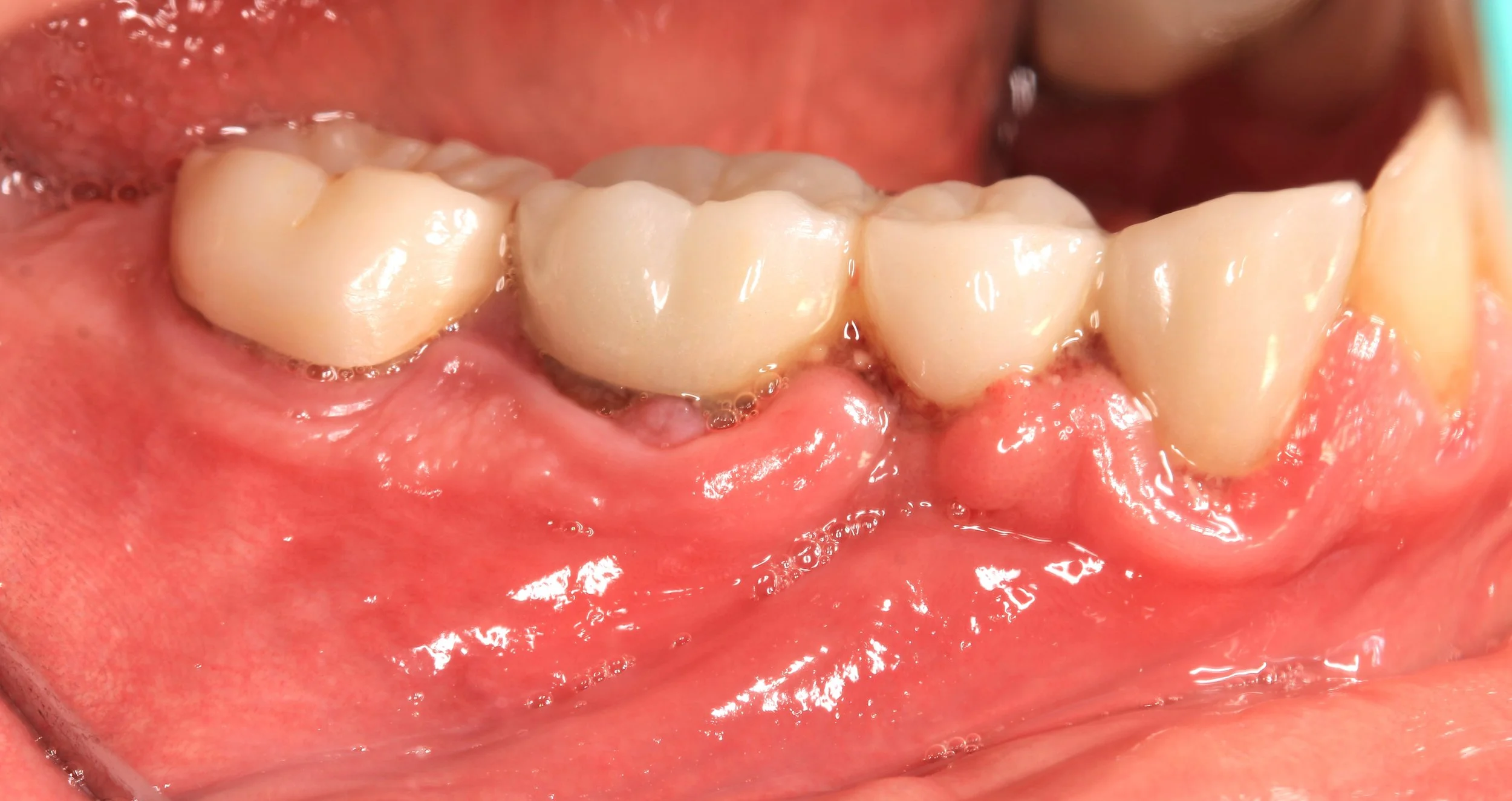 Especialidad en Periodoncia