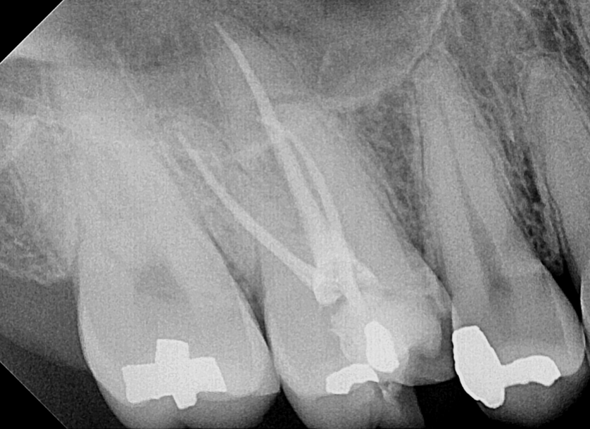 endo 16 terminada.png