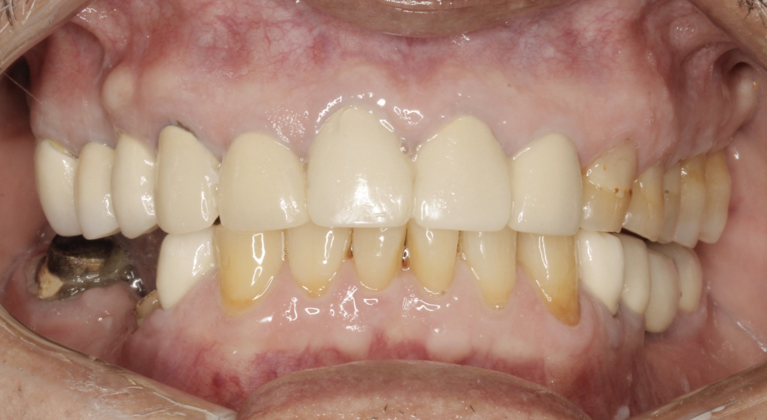 Fotografías iniciales