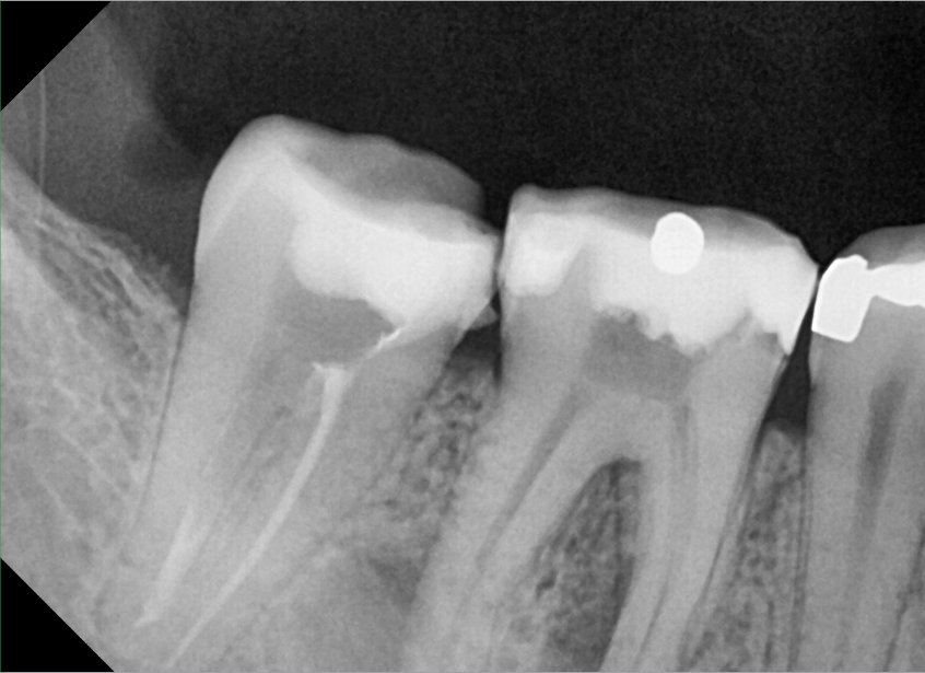 endo 46 y 47 terminada 46.png