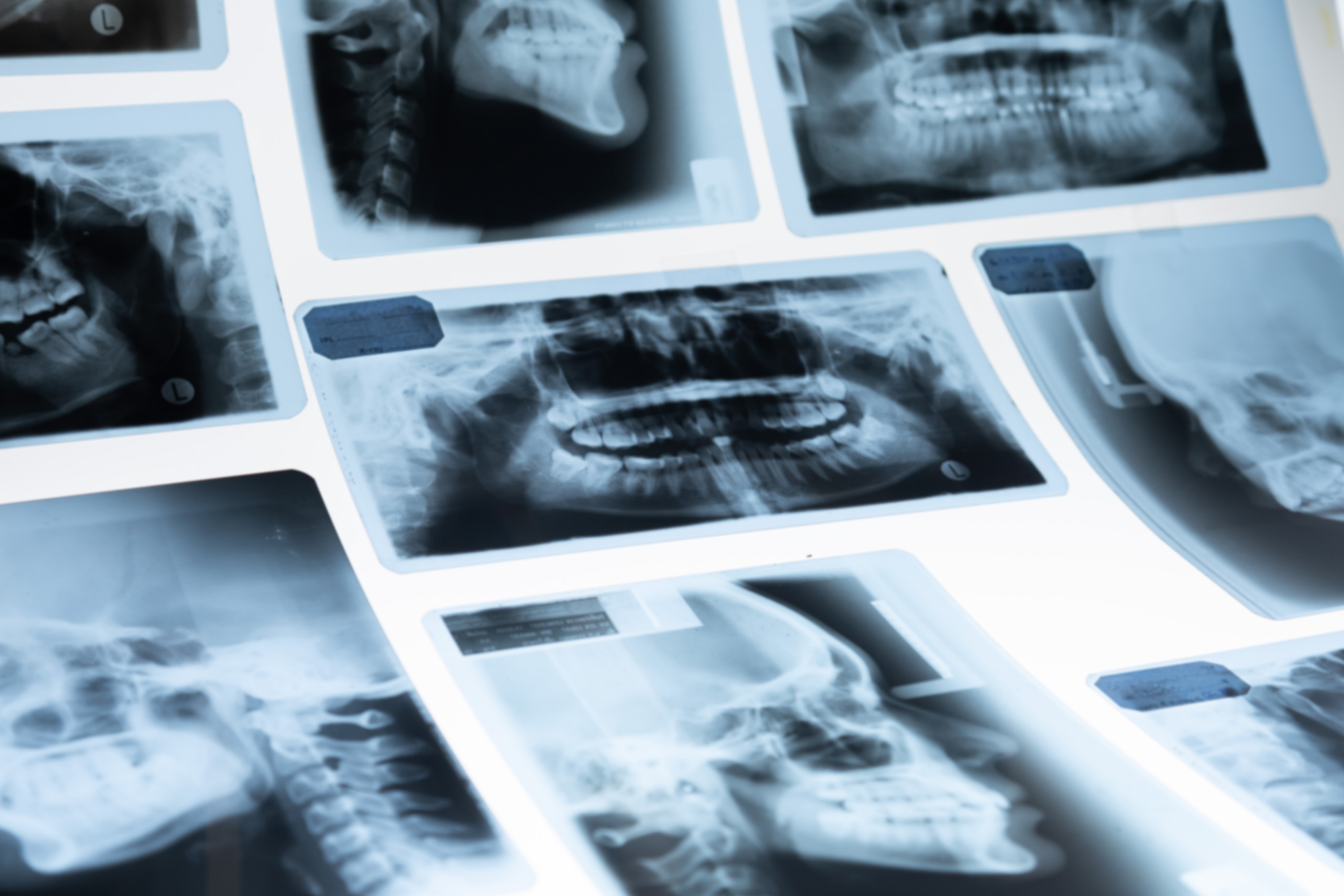 Silver X-ray Film.png