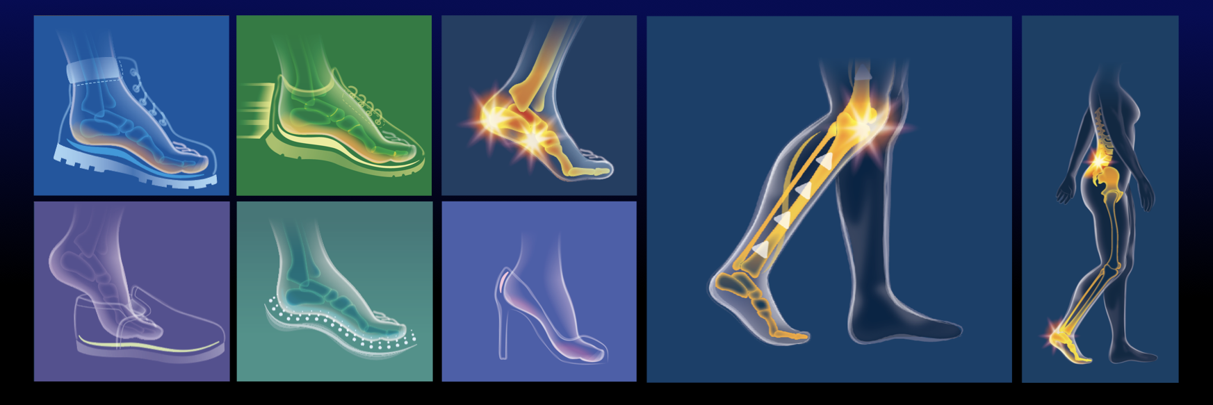 Illustrations of different footwear and foot pain points, including boots, sneakers, running shoes, heels, and barefoot, highlighting pressure points and pain areas in the feet and legs.