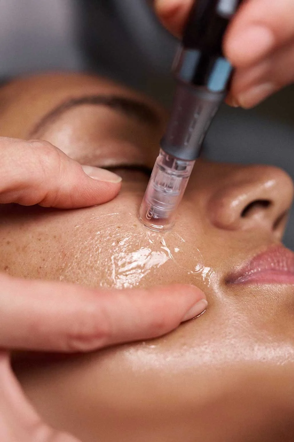 A close-up of a microneedling pen being pressed against a client's cheek, which is coated in a clear numbing gel, during a professional cosmetic nano needling treatment.