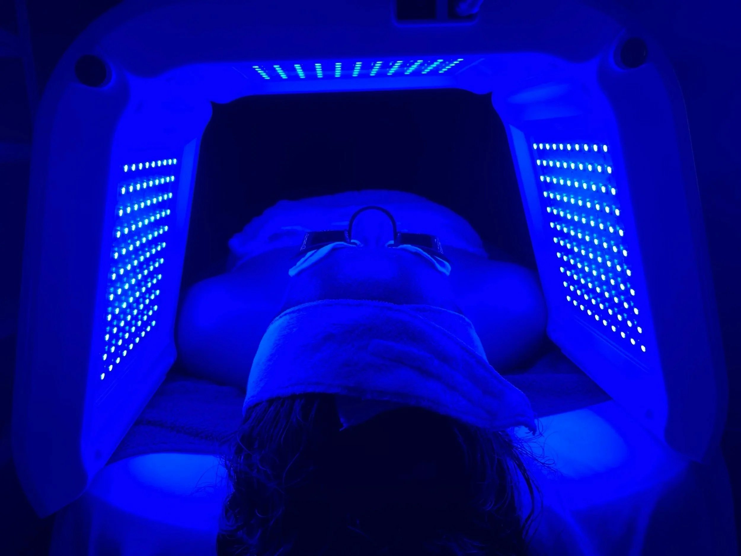 blue led light for el monte acne facials