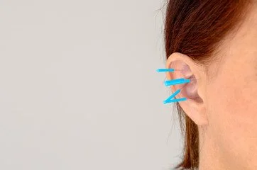 ear acu.jpg