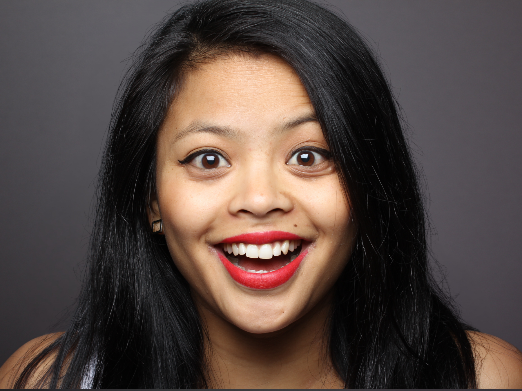 Smiling patient representing wisdom tooth removal and specialty dental care at Dental Care of Cerritos.