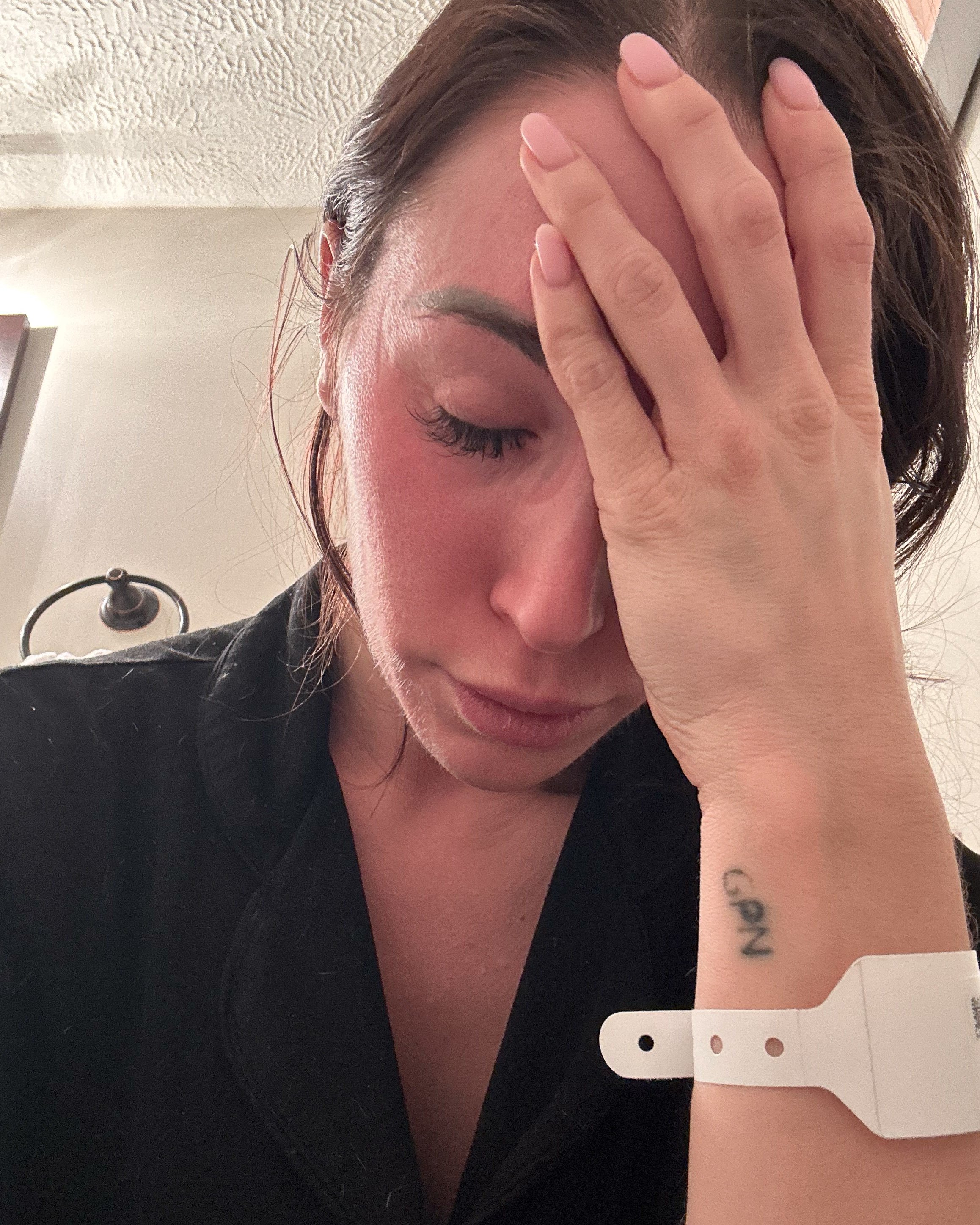 Gabriella Castellani resting her hand against her face while wearing a hospital band on the day of her endometriosis excision surgery