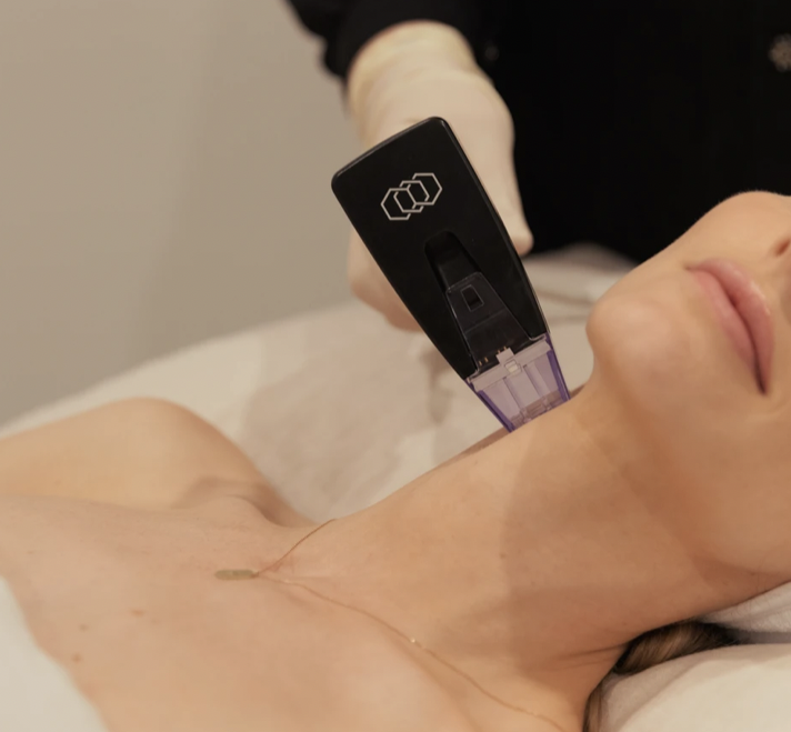 A person receiving a medical or cosmetic procedure with a handheld device on their neck.