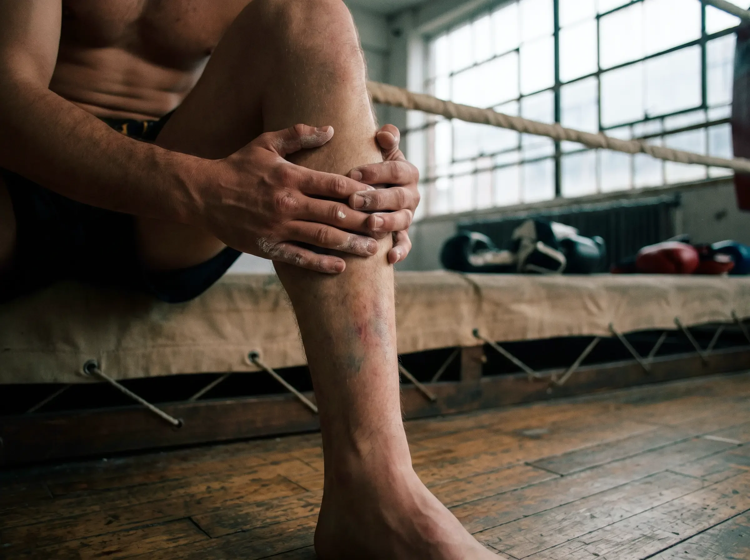 Muay Thai Shin Pain: Bruising, Conditioning and When It's Something More